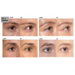 L'Oreal Lu0027Oréal Clinically Proven Wimperserum 9 L'Oreal Lu0027Oréal Clinically Proven Wimperserum -Cosmetica Speciaal Winkel 994623 4